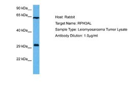 RPH3AL Rabbit anti-Human, Polyclonal, Novus Biologicals 0.1 mL | Buy Online | Novus Biologicals | Fisher Scientific